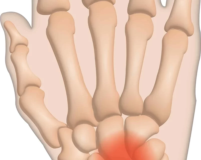 Şahinbey El Cerrahisi Kliniği
