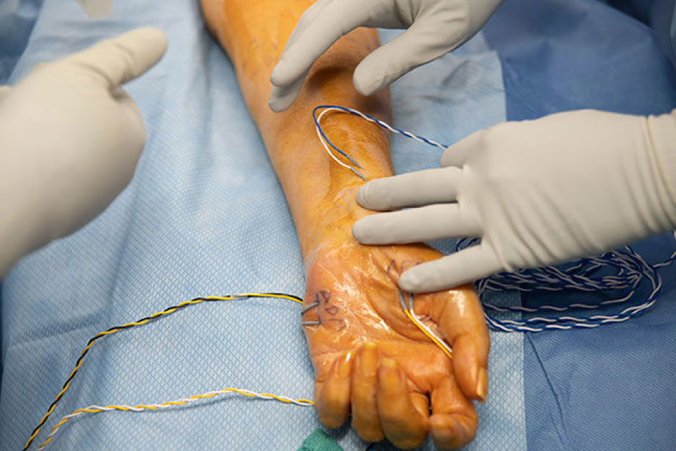 Sinir Yaralanmaları