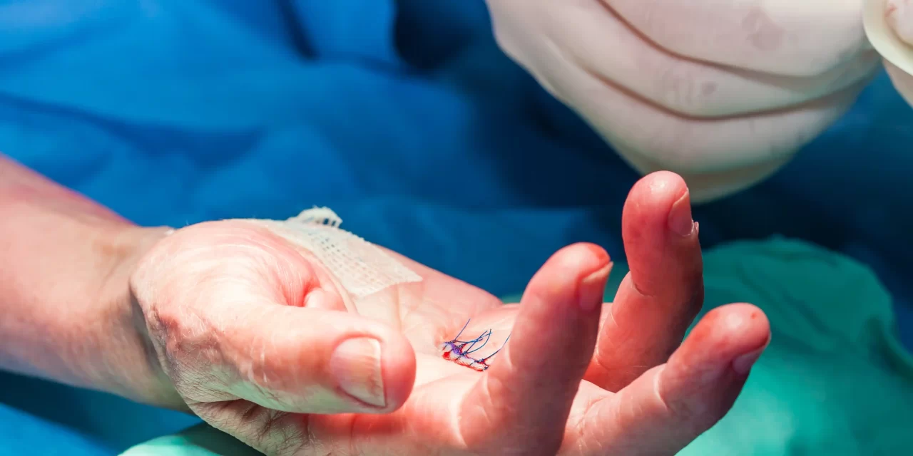 Gaziantep El Cerrahisi Uzmanı