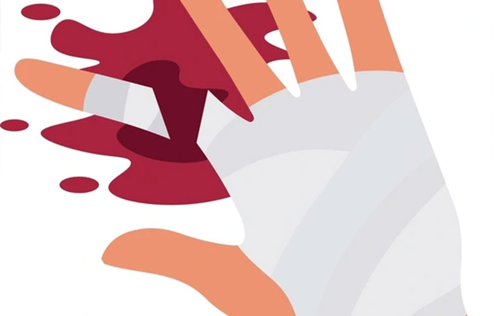 Parmak Kopması (Travmatik Amputasyon)