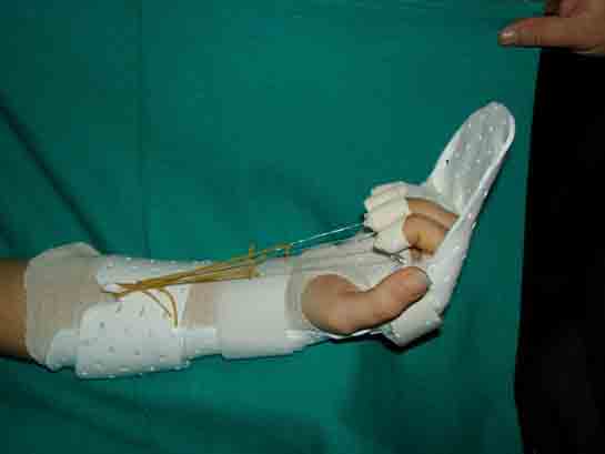 Travmatik Yaralanmalar